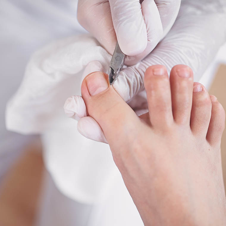 Ta slika ima prazen atribut alt; ime datoteke je Pedikura-02.jpg