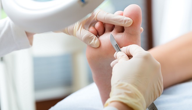 Ta slika ima prazen atribut alt; ime datoteke je medicinska_pedikura.jpg